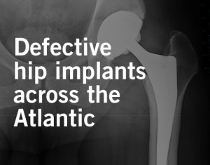 Metal-on-Metal Hip Implant