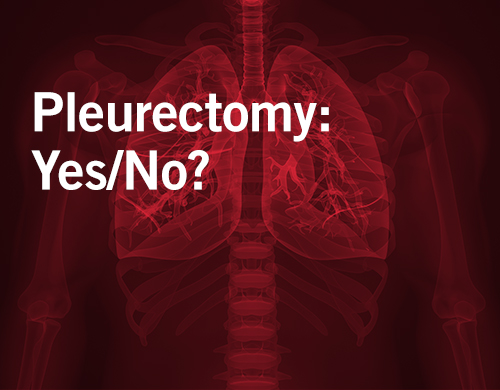 asbestos attorney in Los Angeles