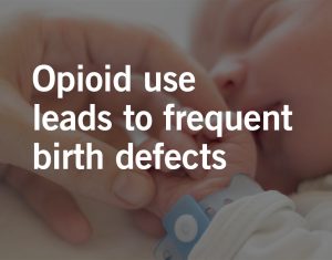 opioid-induced birth defects