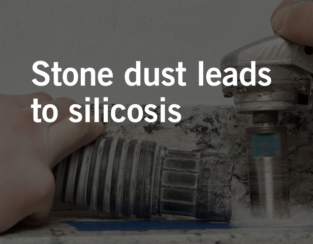 silicosis